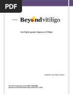 Our Fight Against Stigma On Vitiligo