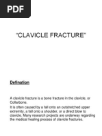 Clavicle Fracture