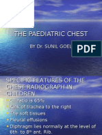 Paediatric Chest Radiology