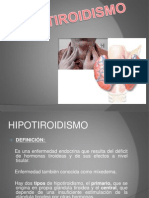 Hipotiroidismo