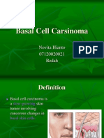 Basal Cell Carsinoma: Novita Hianto 07120020021 Bedah