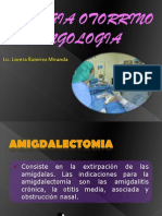 Cirugia Otorrino Laringologia - Amigdalectomia - Septoplastia - Reduccion