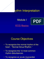 ECG