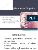 Necrotizing Ulcerative Gingivitis