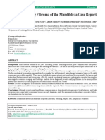 Juvenile Ossifying Fibroma of The Mandible: A Case Report