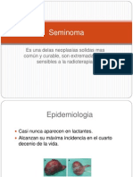 Seminoma