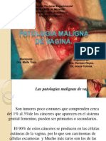 Patologia Maligna de Vagina