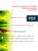 Prosthodontic Management of A Child With Ectodermal Dysplasia