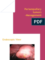 Periampullary Carcinoma