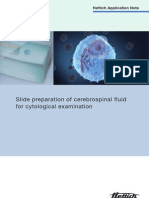 Slide Preparation of Cerebrospinal Fluid For Cytological Examination