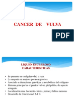 Cancer de Vulva Unu