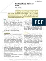 Anesthesia For Systemic Lupus Erythematosus Review