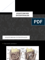 Anastomosis Intestinales