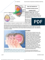 Stem Cell Treatment Alzheimer's Disease - ASCI - Asian Stem Cell Institute