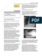 Derrame Pleural