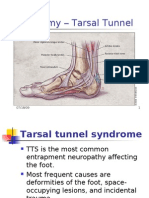 Tarsal Tunnel Syndrome