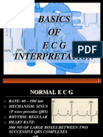 Basics of Ecg