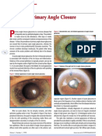 Images of Primary Angle Closure Glaucoma: Ophthalmology in View