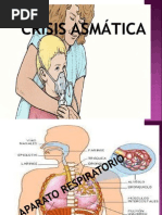 Presentacion Crisis Asmatica