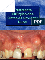 Tratamento Cirúrgico Dos Cistos