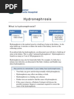 Hydronephrosis LW