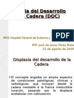 Displasia Del Desarrollo de La Cadera