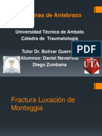 Fractura Luxación de Monteggia y Galeazzi