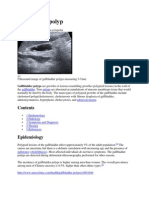 Gallbladder Polyp