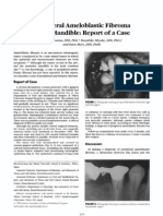 Peripheral Ameloblastic Fibroma