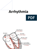 Arrhythmia