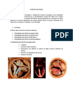 Estenosis Tricuspídea