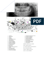 Interpretação Da Radiografia