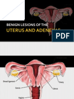 Benign Lesions of The Uterus and Adnexa 2012