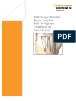 Arthroscopic Shoulder Repair Using The Smith & Nephew Footprint PK Suture Anchor