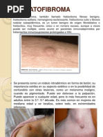 Derma To Fibroma