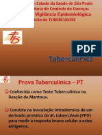 Aula05dots Prova Tuberculinica