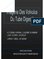 Volvulus Du Grele