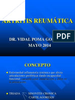 Artritis Reumatica