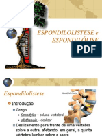 Espondilolistese e Espondilolise