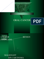 Oral Cancer