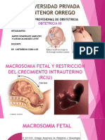 Macrosomia Fetal