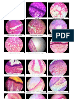 Squamous Cell Onion Cell Simple Squamous - Lungs