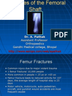 Fracture Shaft Femur