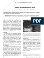 Malignant Mesothelioma of The Tunica Vaginalis Testis: Case Report