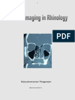 Role of Imaging in Rhinology