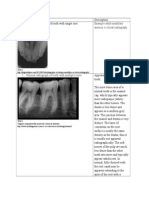 Example Adult Maxillary Anterior Occlusal Radiograph.: Source