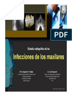 Infecciones de Los Maxilares Diagnostico PDF