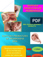 Ruptura Prematura de Membranas