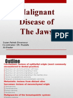 Malignant Disease of The Jaws