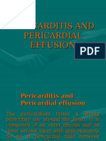 Pericarditis and Pericardial Effusion